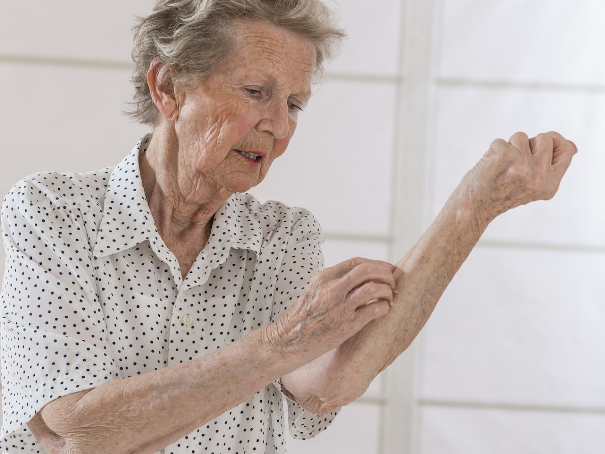 senior woman scratching arm